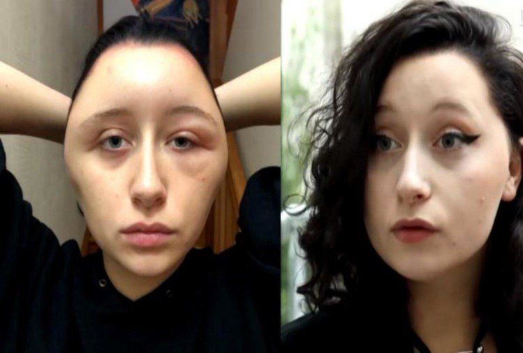 News Photo 1 - Europe - Otta Nottathil - 51220189hairdye