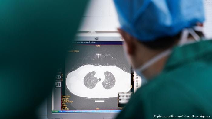 News Photo 1 - Other Countries - Otta Nottathil - 21320203lungs