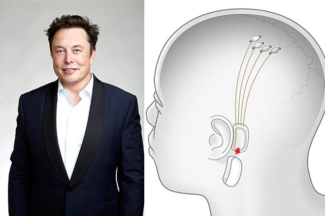 News Photo 1 - America - Finance - 4320235musk